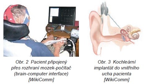 Biomedicínské inženýrství Terminologie 1